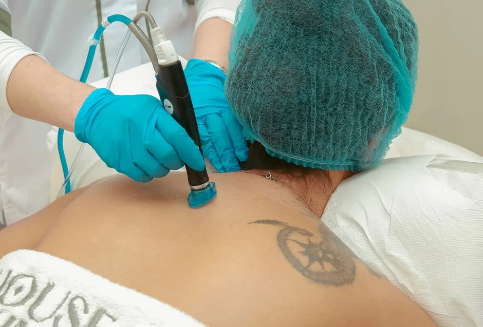 Cryotherapie diensten